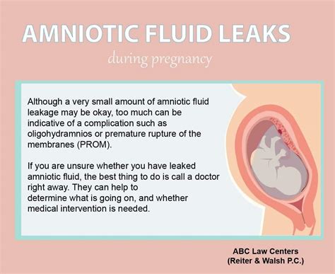 Leaking Amniotic Fluid During Pregnancy